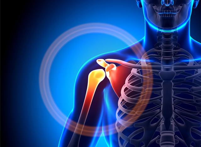 ¿DOLOR EN EL MANGUITO ROTADOR?