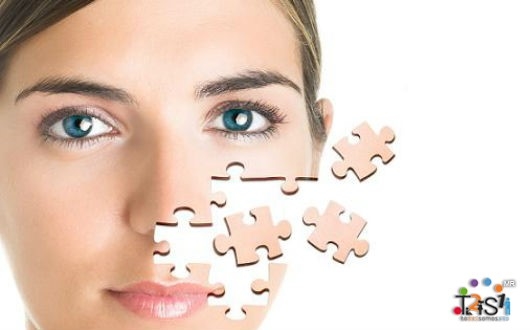 QUÉ HACER EN CASO DE PRESENTAR UNA PARÁLISIS FACIAL