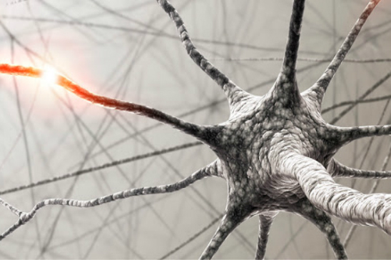 ESCLEROSIS MÚLTIPLE