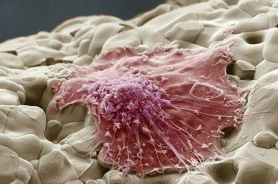 ¿CÓMO SE REPARAN LOS TEJIDOS TRAS UNA LESIÓN?