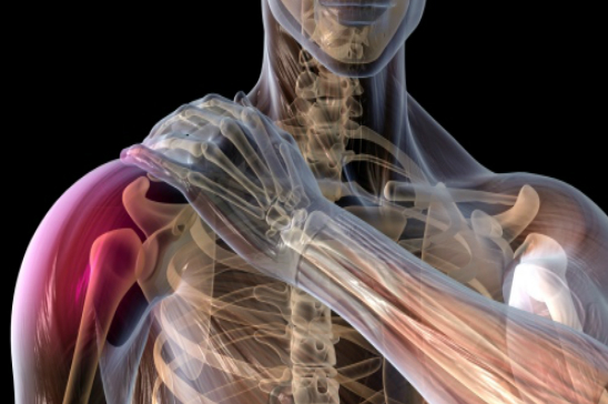 LESIÓN DEL MANGUITO ROTADOR