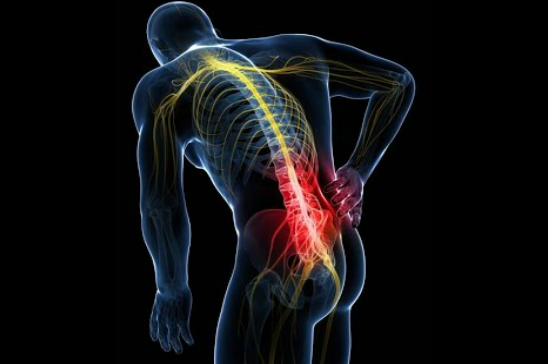 NO TODAS LAS HERNIAS DE DISCO NECESITAN CIRUGÍA